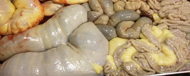 Intestines